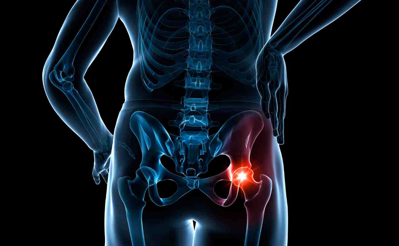 X-ray-style anatomical illustration of the pelvis and hip joint with the right hip highlighted in red, indicating chronic hip pain