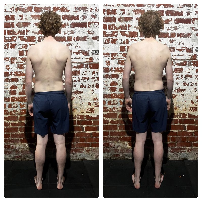 Charles back view — improved spinal alignment