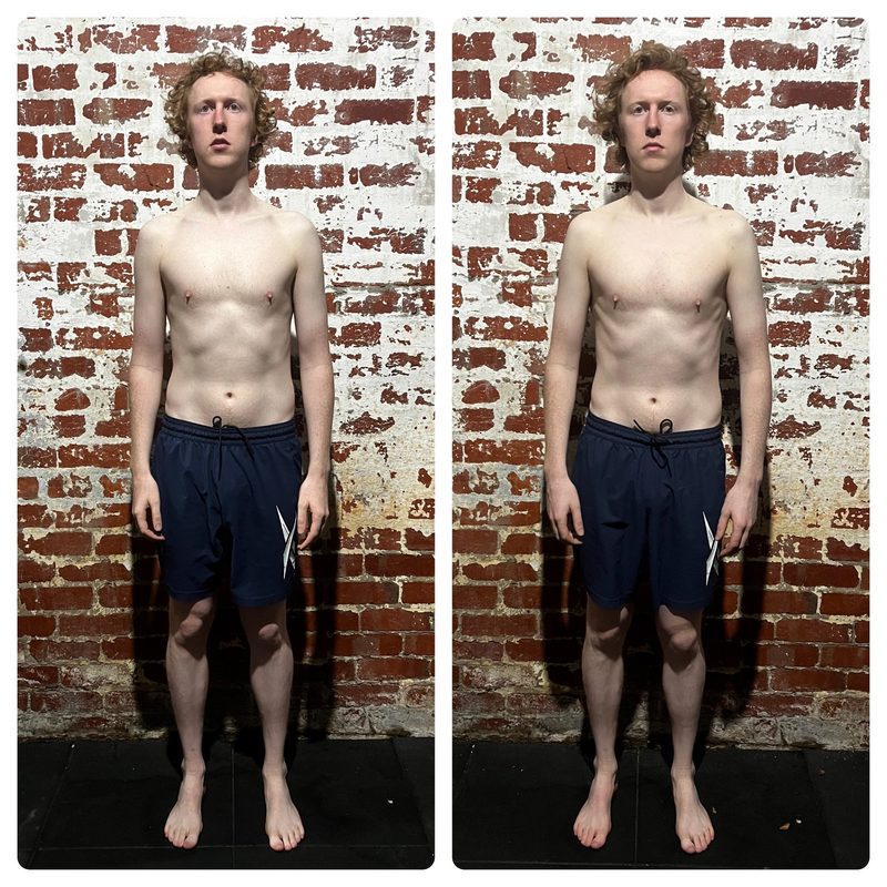 Charles front view — improved posture alignment