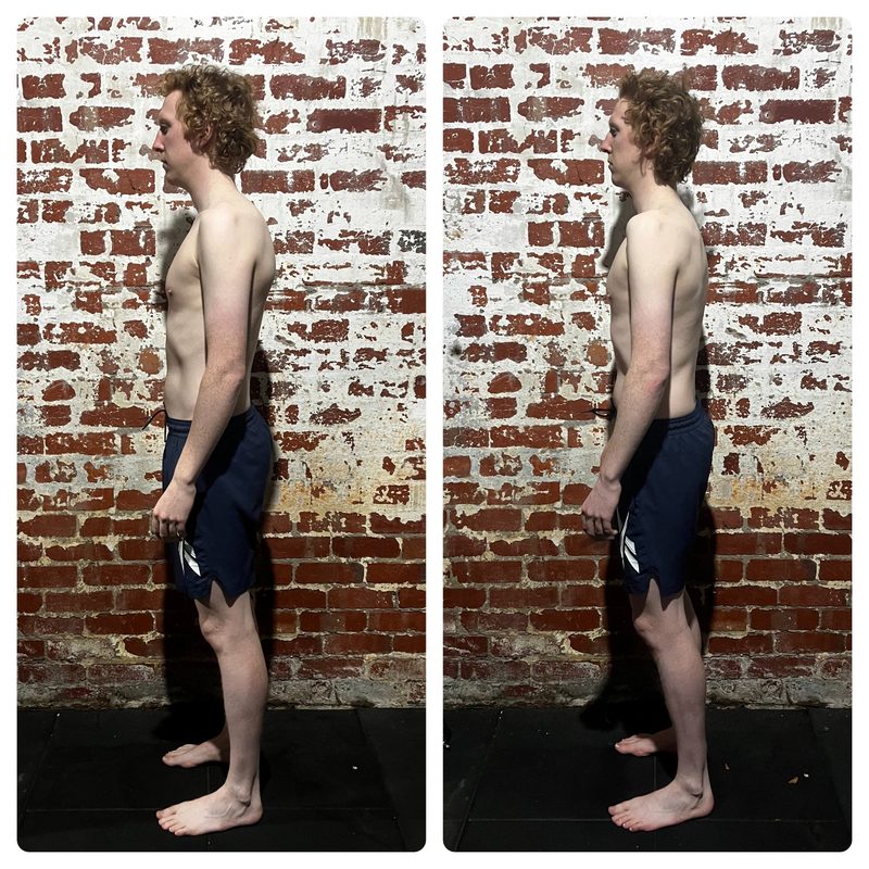 Charles left side — reduced forward head posture