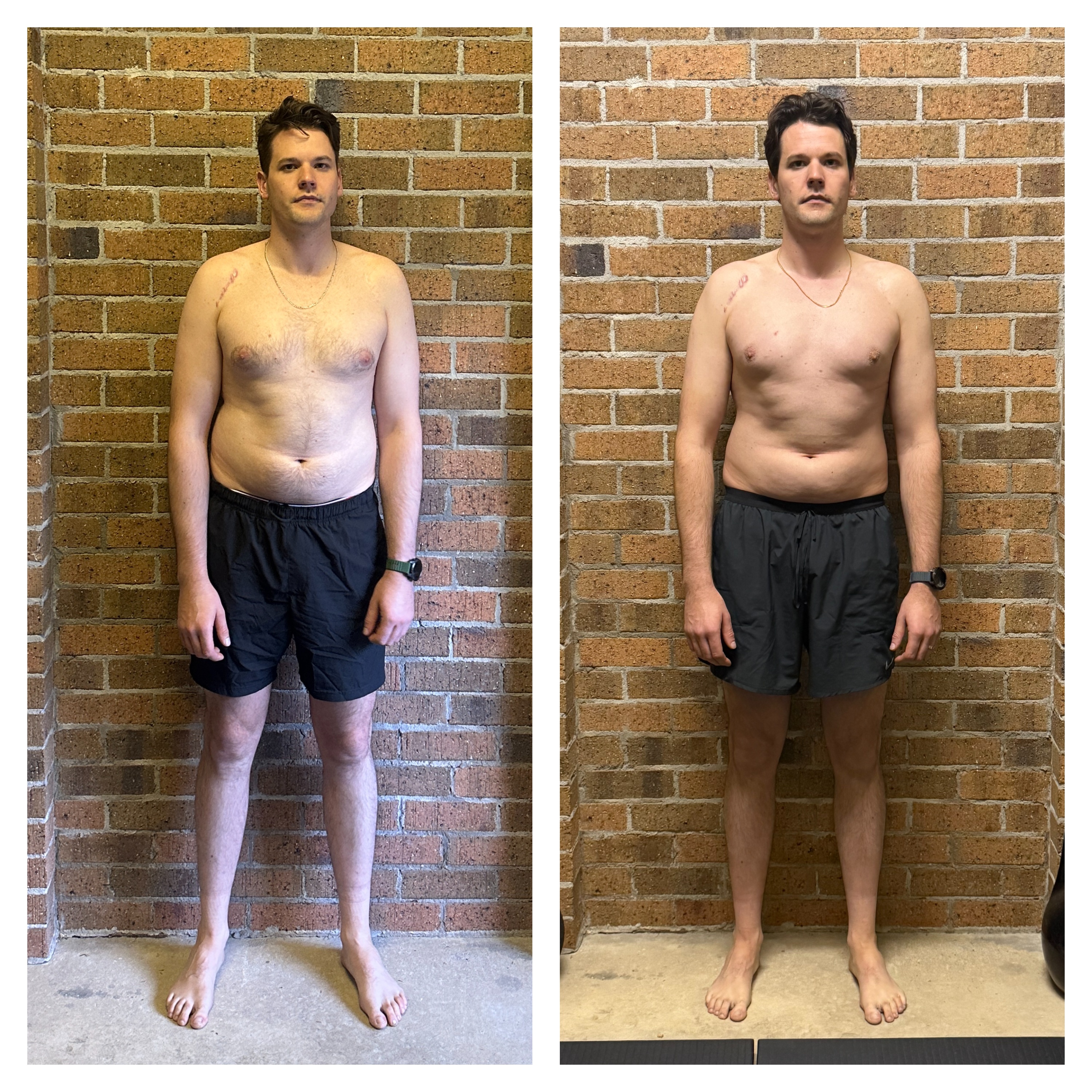 Taras front view — improved posture and alignment