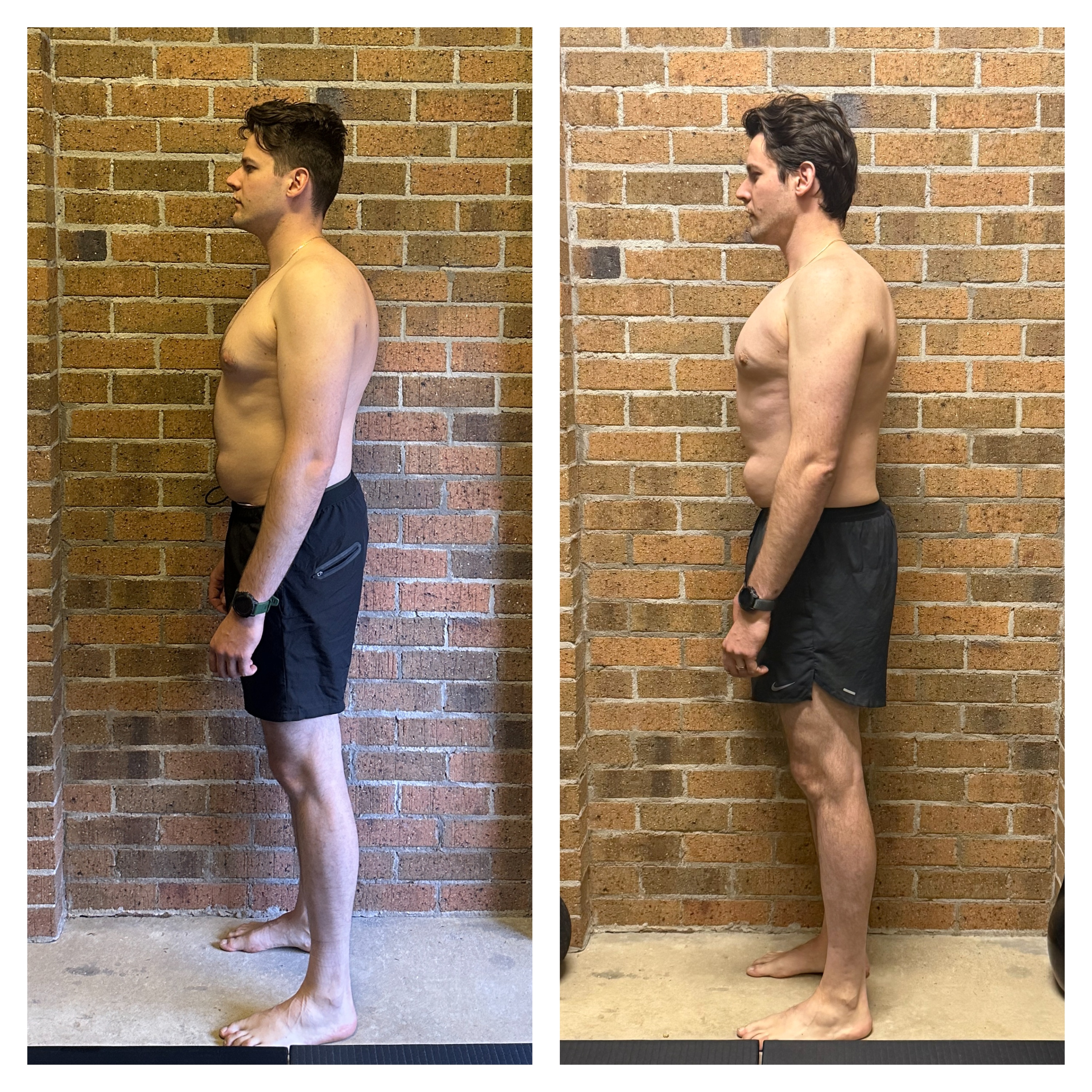 Taras left side — improved spinal alignment